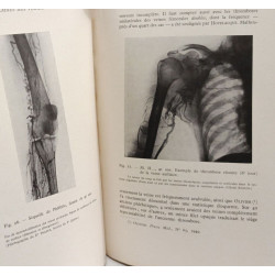 Traité des maladies des veines